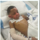 Illustration for article titled 7-Year-Old Missouri Boy Set on Fire With Nail Polish Remover by 8-Year-Old Neighbor, Mom Says
